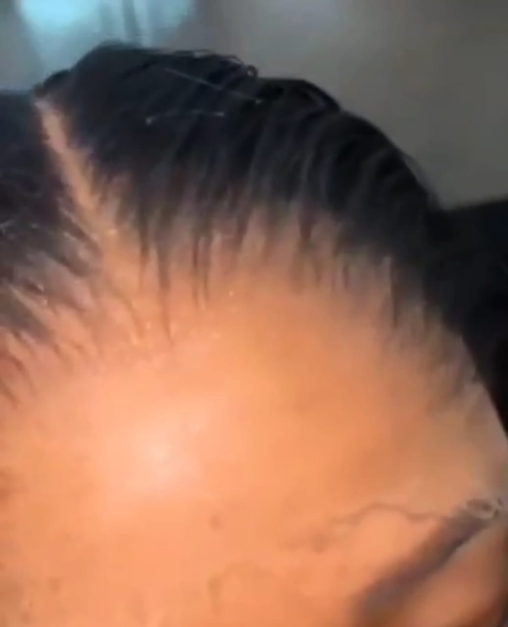 Frontal install lekki, Ikoyi, Victoria Island Best Salon