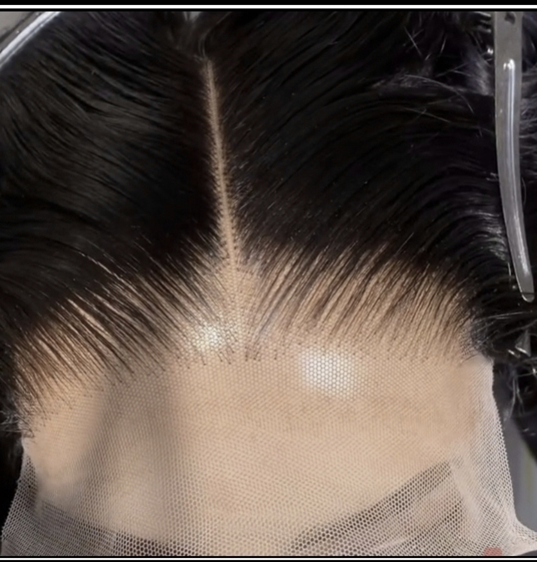 Prepluck hairline